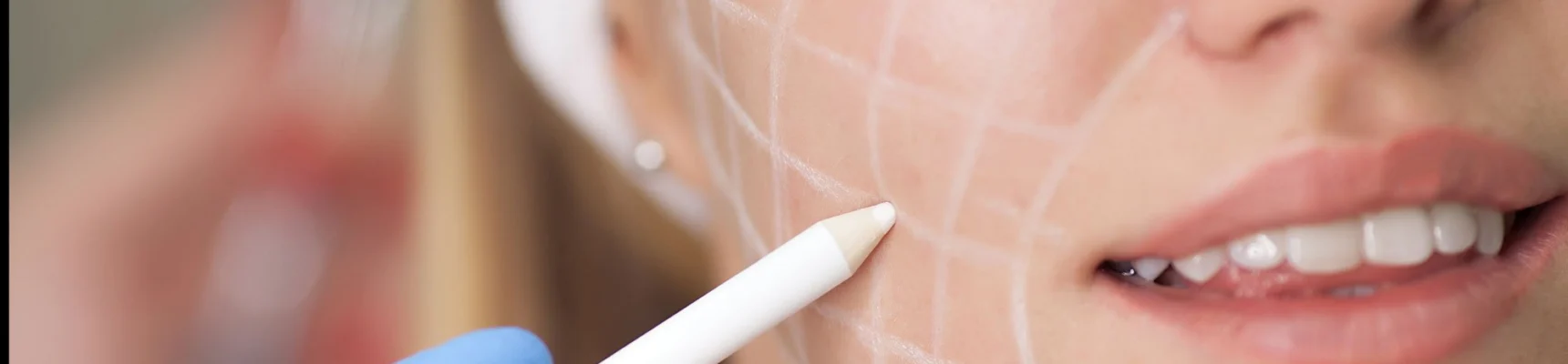 Υαλουρονικό Οξύ & Fillers – Δρ. Παναγιώτης Μάνταλος, πλαστικός χειρουργός Αθήνα